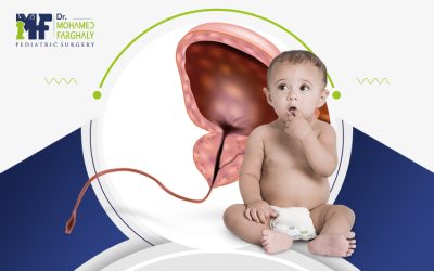 عملية الاحليل السفلي الدرجة الاولى