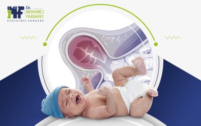 الفتق الاربي عند الرضع وأفضل طرق التعامل معه