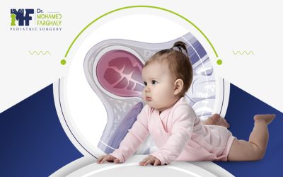 الفتق الاربي عند البنات: متى يظهر وكيف يُعالج؟