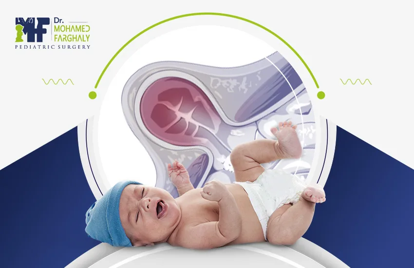 الفتق الاربي