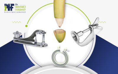 انواع الختان: ومتى تختار الطريقة الأنسب لطفلك؟