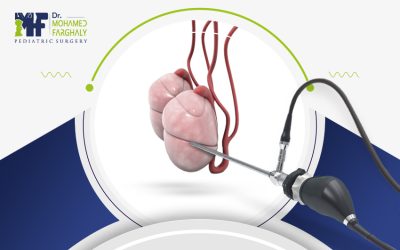 تكلفة عملية انزال الخصية المعلقة 2025