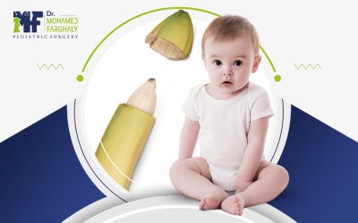 اسعار عملية الطهارة للذكور في مصر