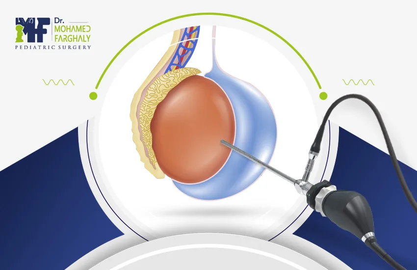 عملية القيلة المائية 