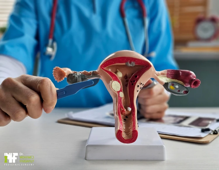 عملية القيلة المائية بالمنظار عملية القيلة المائية بالمنظار