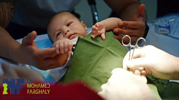 تكلفة عملية ختان الذكور