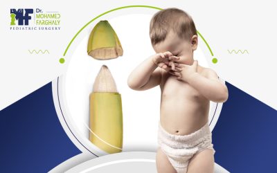 اضرار عدم الختان للذكور: مخاطر صحية قد لا تعرفها