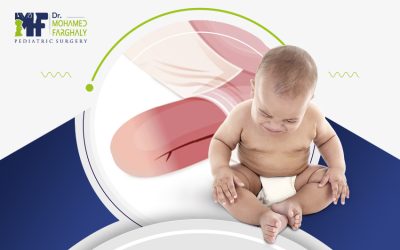 اعراض الفتق الاربي عند الأطفال: كيف تكتشفه مبكرًا؟