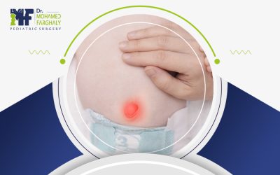 اعراض الفتق السري عند الأطفال: العلامات المبكرة وطرق التشخيص