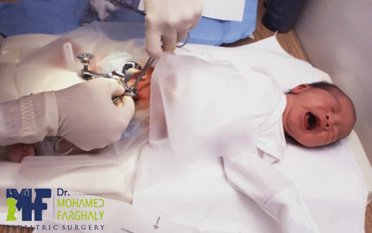 مدة شفاء الطفل بعد الختان