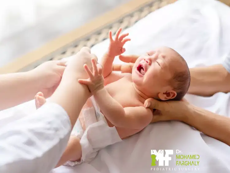 ختان الطفل بعمر شهرين