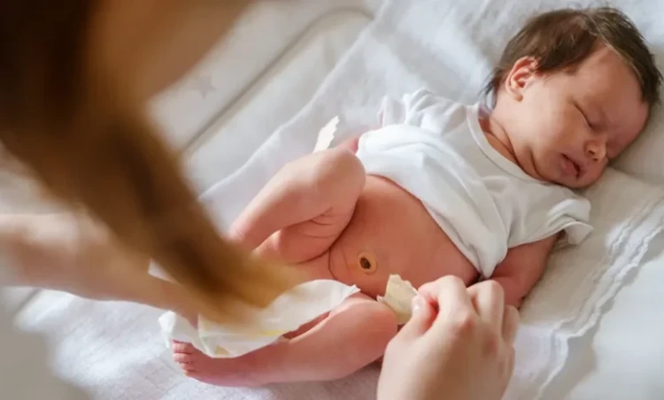 ختان الطفل بعمر شهرين ختان الطفل بعمر شهرين