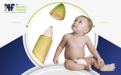 عملية الطهارة للرضع: متى تُجرى وكيفية العناية بعد الختان