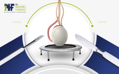 عملية تثبيت الخصية النطاطة للاطفال: الاسباب وخطوات الجراحة