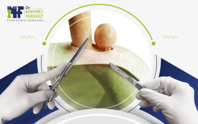 نسبة نجاح عملية فتق الحجاب الحاجز للمولود