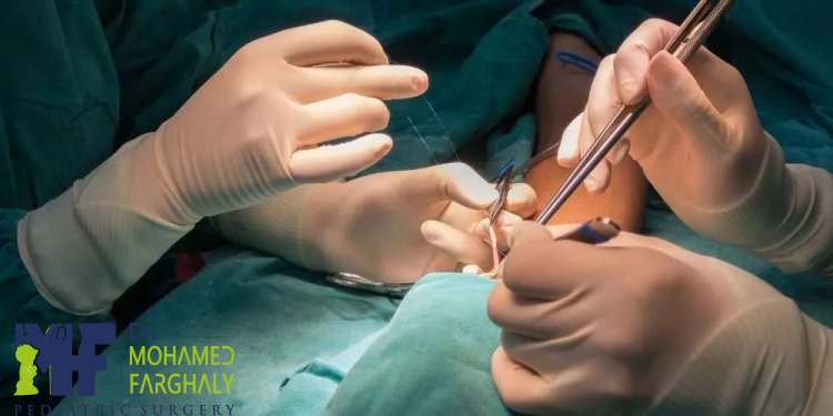 كم تستغرق عملية الخصية المعلقة للاطفال