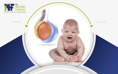 ما اسباب القيلة المائية عند الأطفال؟ وكيف تُعالَج؟