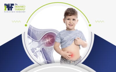 اعراض اختناق الفتق السري | خطر يهدد حياة طفلك