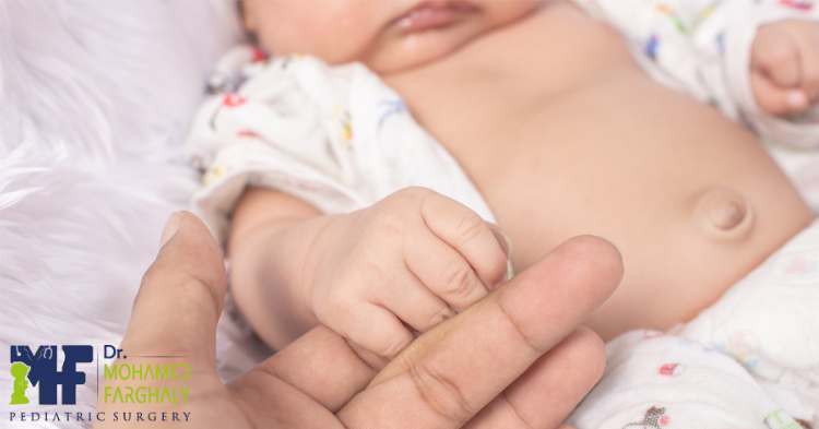 العناية بالطفل بعد عملية إصلاح الفتق السري