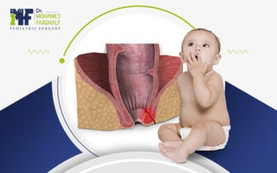 شكل الناسور عند الاطفال| أنواع الناسور عند الأطفال وطرق علاجها