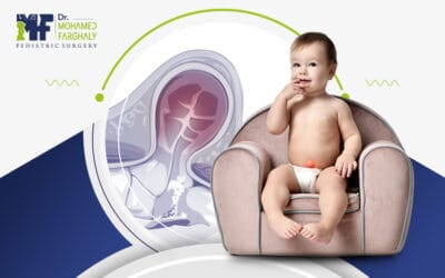 كيف يكون شكل فتق السرة عند حديثي الولادة؟