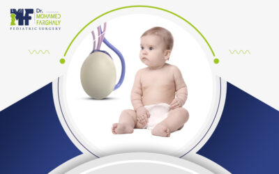 متى تُجرى عملية تثبيت الخصية للاطفال؟ وكيف؟ إليكم التفاصيل