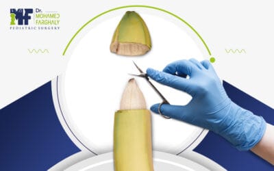 شكل الذكر بعد الختان بالصور وما يمكن توقعه بعد العملية