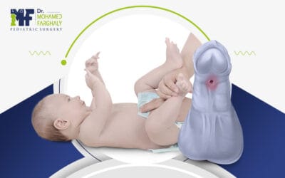 ما بعد عملية الاحليل السفلي: ماذا يحتاج طفلك؟