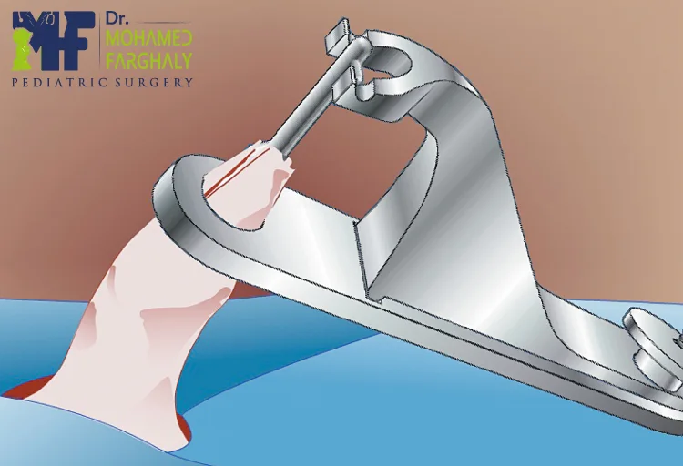 ما هو جهاز الجومكو للطهارة؟