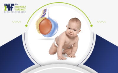 متى أقلق بشأن اعراض ما بعد عملية القيلة المائية؟