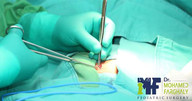 الجراحة الفورية إجراء ضروري لإنقاذ الأطفال من مضاعفات خطيرة