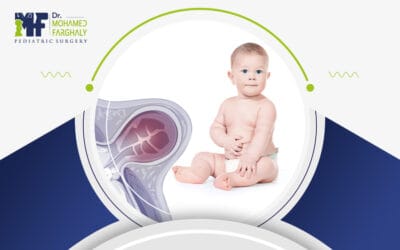 انواع الفتق السري عند الأطفال وخطورة إهمال المتابعة الطبية