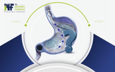 ما هو ارتجاع المرئ؟ وهل يعد خطرًا على رضيعي؟