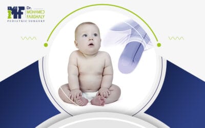 كيفية إجراء عملية توسيع مجرى البول