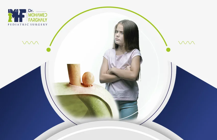 عملية فتق الحجاب الحاجز بالمنظار