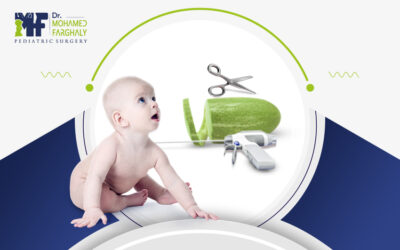 ايهما افضل الختان بالليزر او الجراحه؟