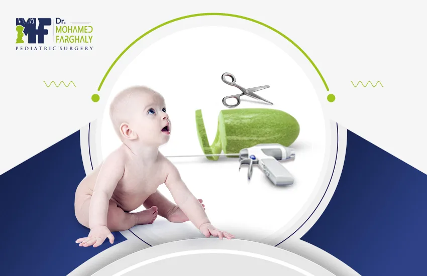 ايهما افضل الختان بالليزر او الجراحه