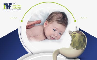 طرق علاج ارتجاع المرئ اثناء النوم