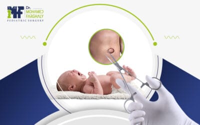 تعرّف إلى كيفية اجراء عملية الفتق السري للأطفال