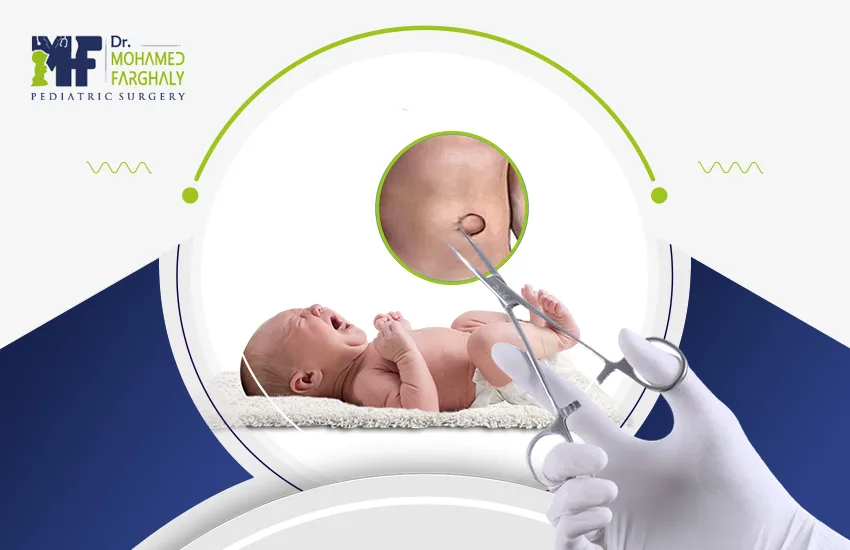 كيفية اجراء عملية الفتق السري