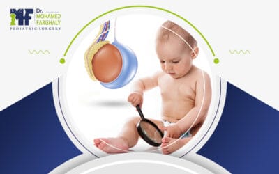 انتفاخ الخصية بعد عملية القيلة المائية: أمر طبيعي أم خطر يجب الانتباه له؟