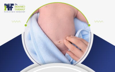كيف يبدو شكل البطن بعد عملية الفتق السري؟