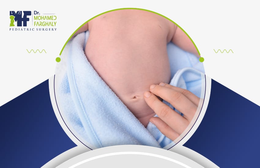 شكل-البطن-بعد-عملية-الفتق-السري شكل البطن بعد عملية الفتق السري