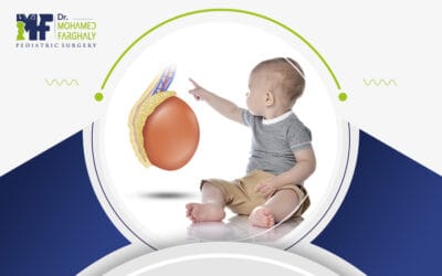 تعرف على شكل الخصية بعد عملية القيلة المائية لدى طفلك