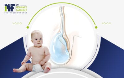 شكل القيلة المائية عند الأطفال: هل تدعو للقلق؟