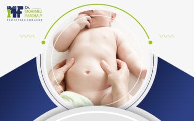 ما بعد عملية الفتق السري.. أمور طبيعية وأخرى تستدعي القلق!