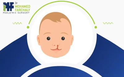 تعرف على شكل الشفة الارنبية قبل وبعد علاجها