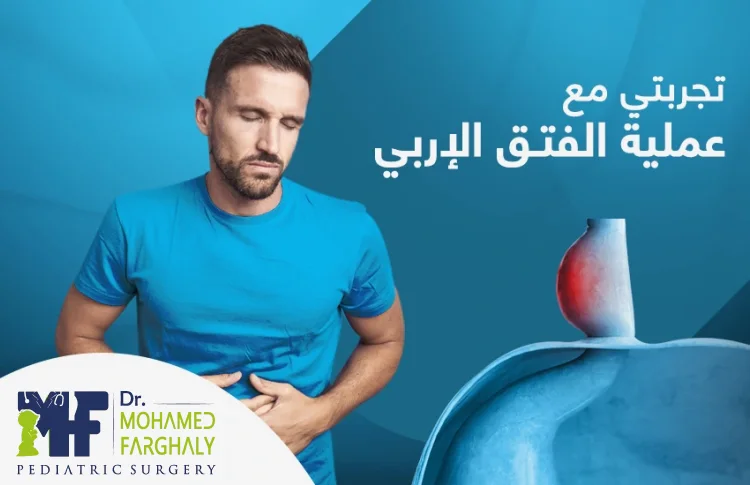 تجربتي مع عملية الفتاق