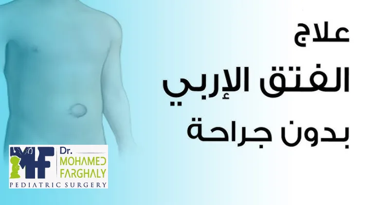 علاج فتق الخصية بدون جراحة عند الأطفال