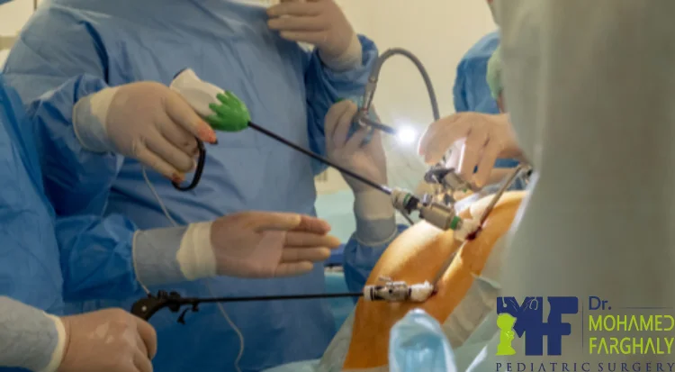 كم تستغرق عملية فتق الحجاب الحاجز بالمنظار؟